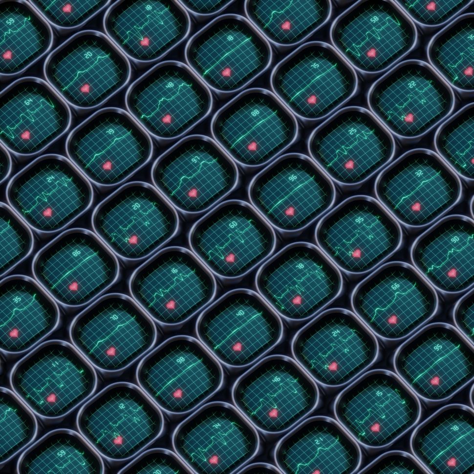 A repeated pattern of heart rate monitors